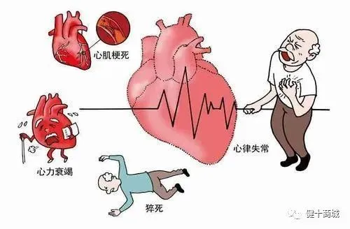 冠心病介入治疗病例_冠心病介入治疗指证_冠心病介入诊疗