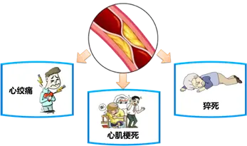 冠心病康复护理的内容_冠心病康复护理_康复护理冠心病常用药物