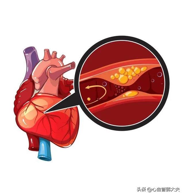 预防冠心病的早期症状_预防冠心病发作及其自救方法_冠心病得预防治疗方法