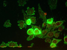 呼吸道合胞病毒英文_呼吸系统合胞病毒_呼吸道合胞病毒rna