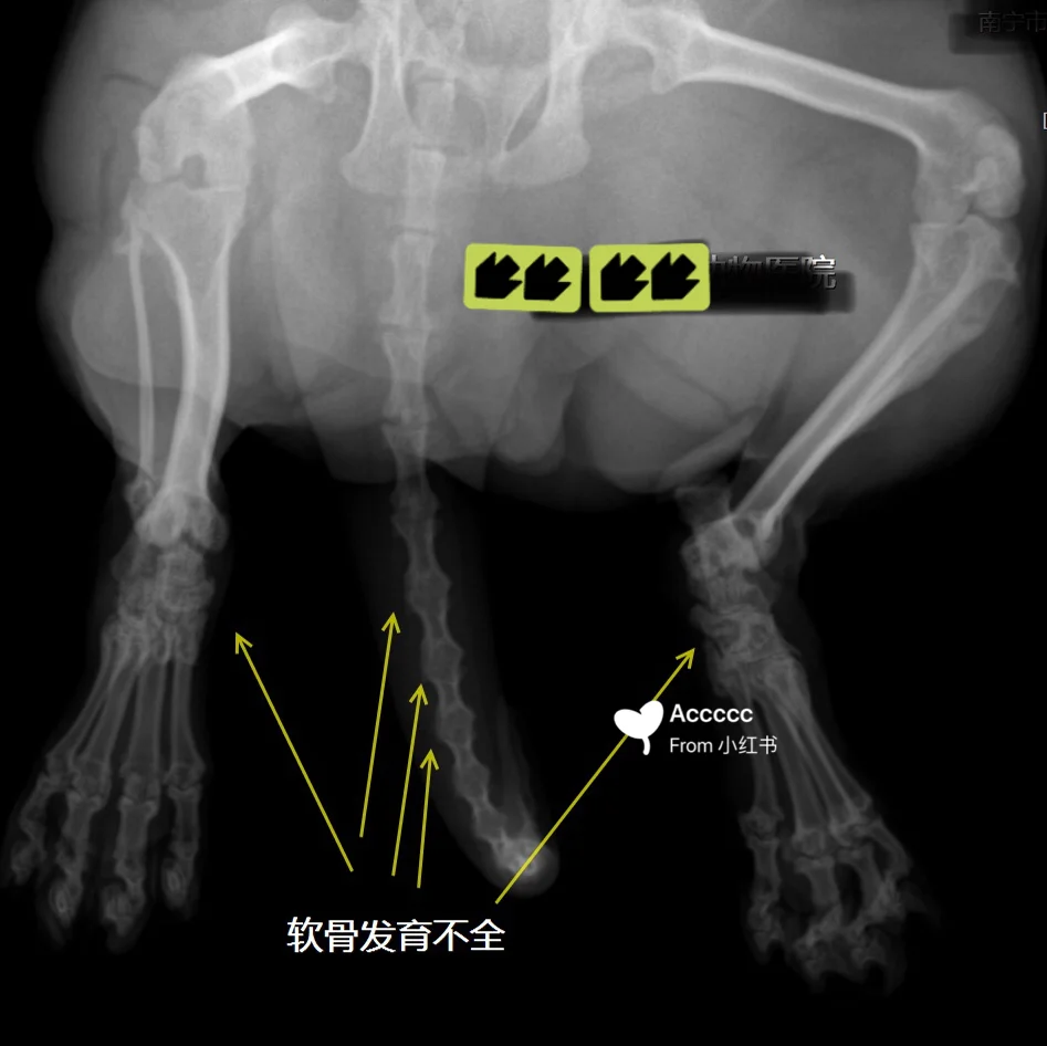 小儿哮喘发病年龄最多见于_小儿哮喘发作期的病机是_小儿哮喘发病年龄多见于