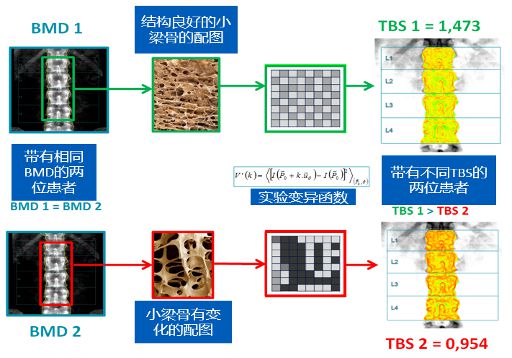 tbs系统,什么是TBS系统？