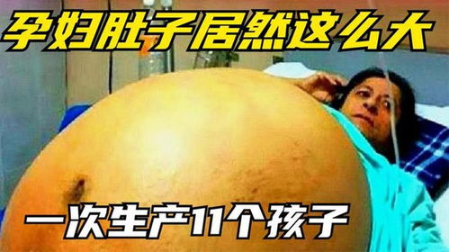 大肚子怀孕生孩子游戏