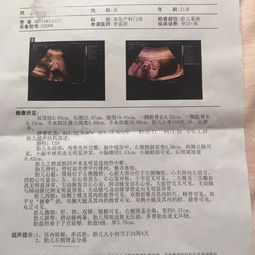 安卓攻略系统b超,轻松掌握B超操作与解读技巧